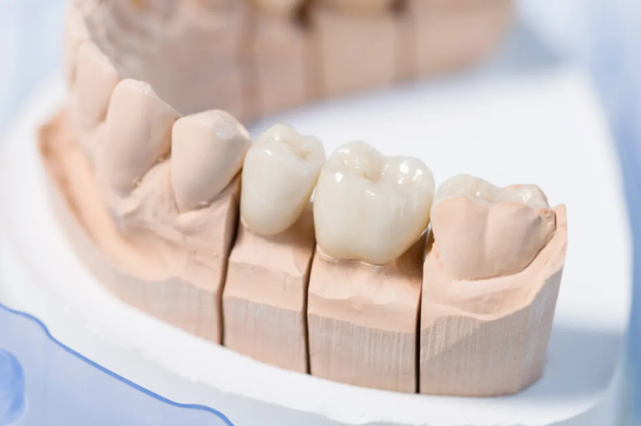 Dental restorative materials