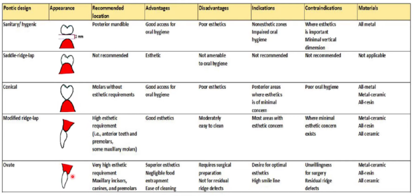 Summary of the characteristics of different bridge gingival surface designs