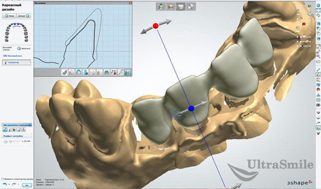 Understanding CAD/CAM Technology