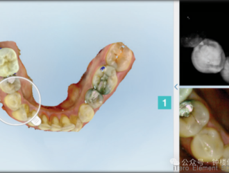 Application of AI in the Field of Prosthodontics