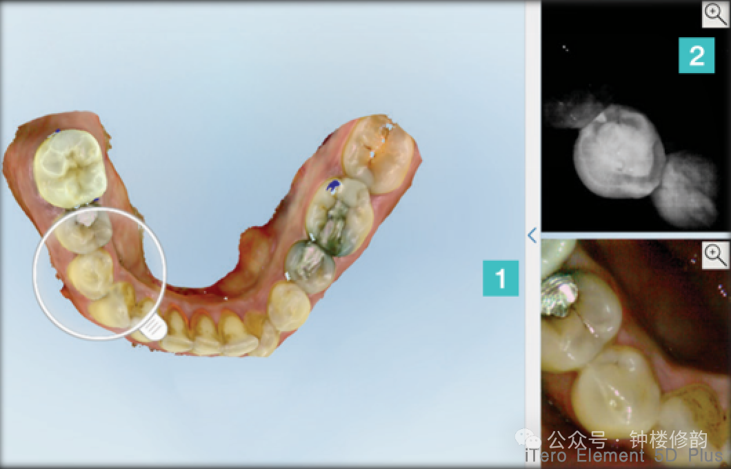 Application of AI in the Field of Prosthodontics