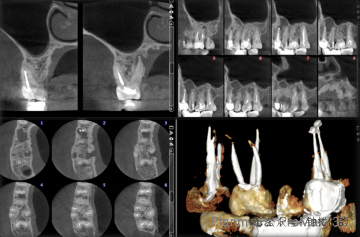 Intelligent Dental X-ray Machine