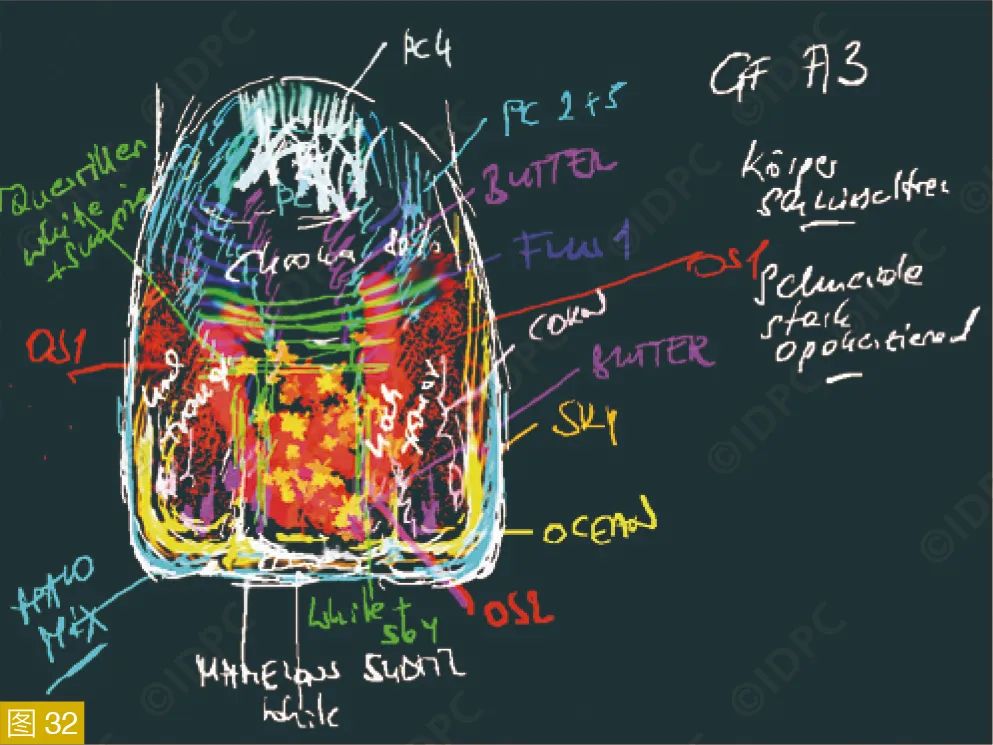 **Figures 31-32:** Shade determination and layering scheme for the personalized crown.