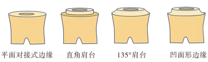 Design of inlay crown margins