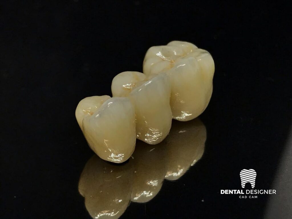 zirconia dental