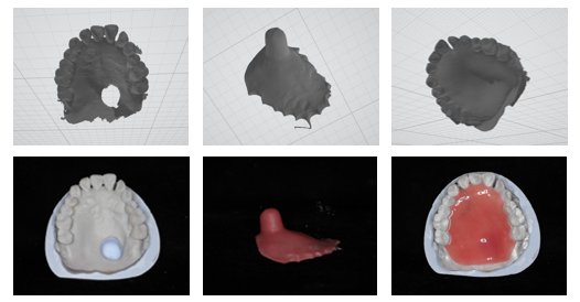 Fig.12 Digital design of palatal plate