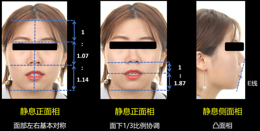 Figure 2 Facial image of the patient before treatment.