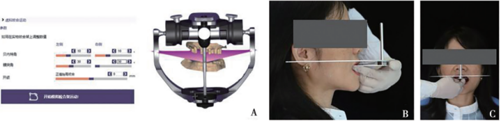 Fig. 5 Digitally determining the merging plane